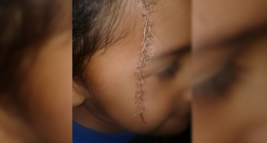 Maltrato infantil: denunci&oacute; al padre y a la abuela por violencia f&iacute;sica contra un menor de 5 a&ntilde;os
