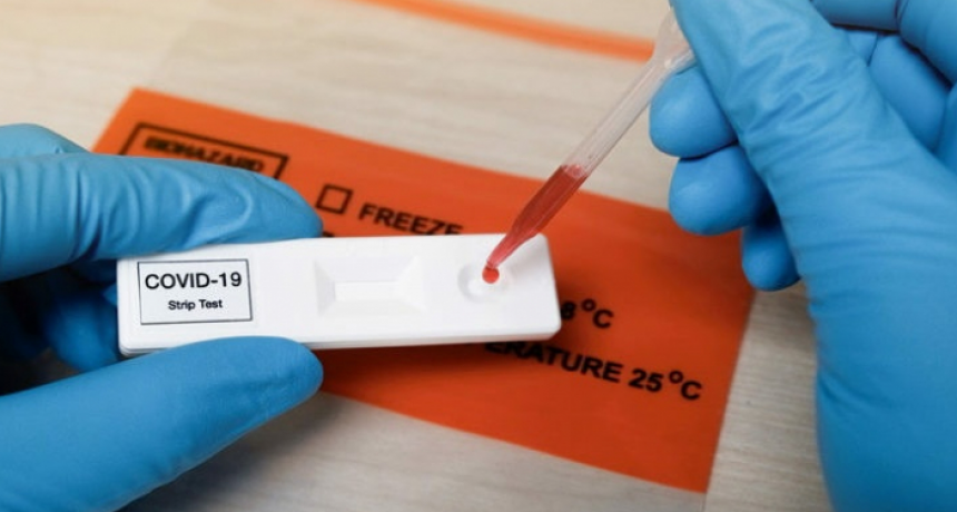 Confirmaron 466 nuevos contagios de COVID y 8 muertes en las &uacute;ltimas 24 horas