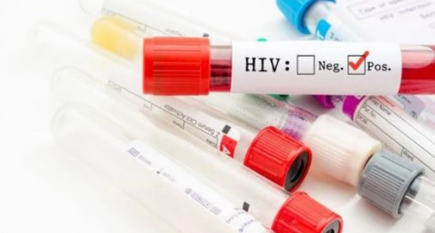 Descubren una variante del VIH m&aacute;s virulenta y contagiosa